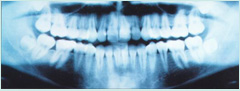 X-ray showing healthy teeth